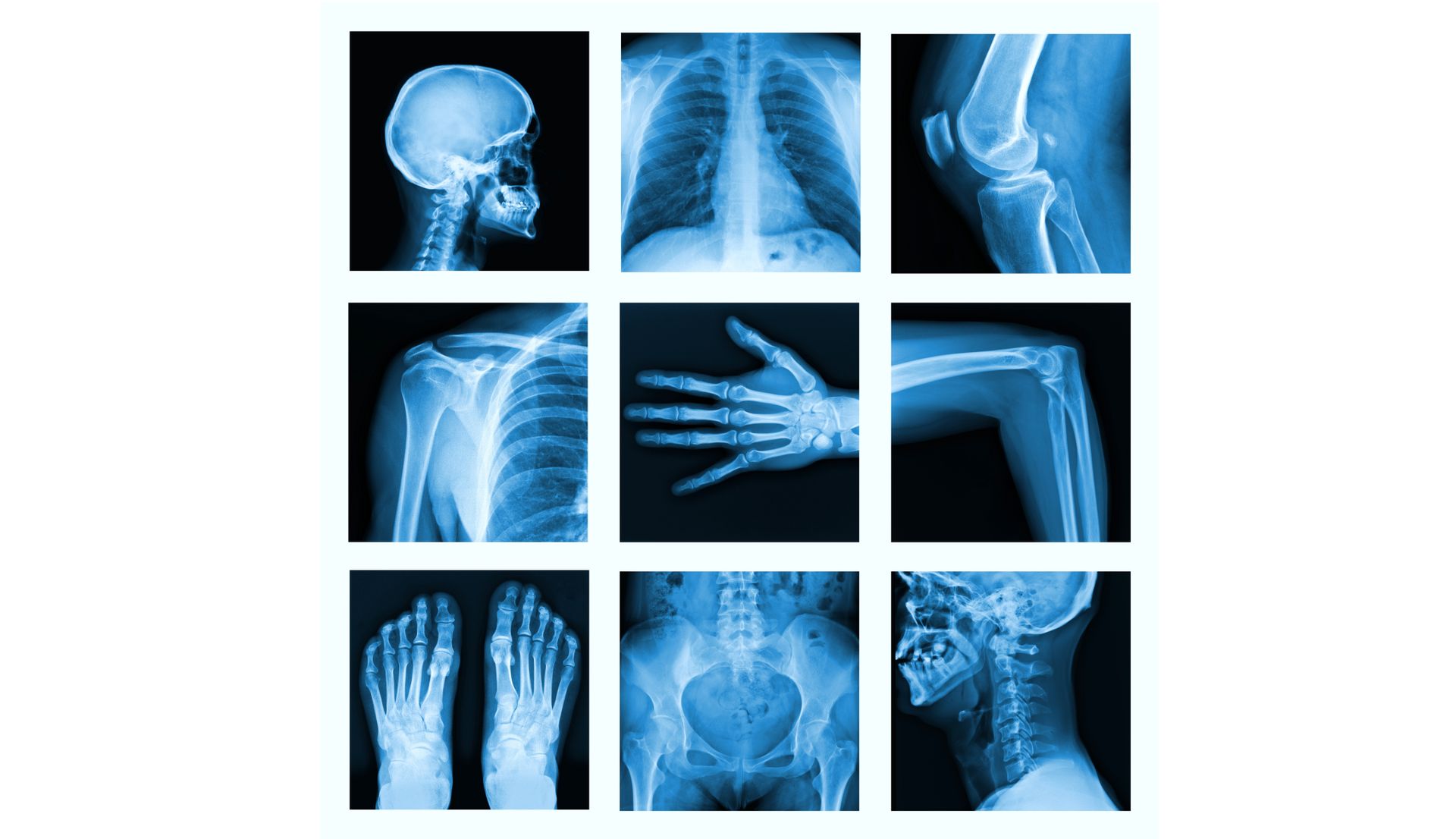 Рентгенівські промені: історія відкриття